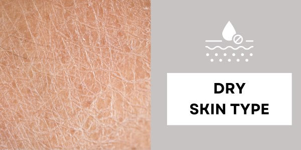 Dry Skin Type