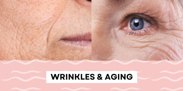 Wrinkles and Aging